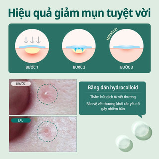 Miếng Dán Mụn Some By Mi Clear Spot Patch 18 miếng