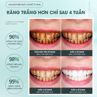 Bàn Chải Điện 5 Chế Độ Lông Chải Mềm Mại Cao Cấp Giúp Bảo Vệ Răng Nướu, Bộ Bàn Chải Răng,Bàn Chải