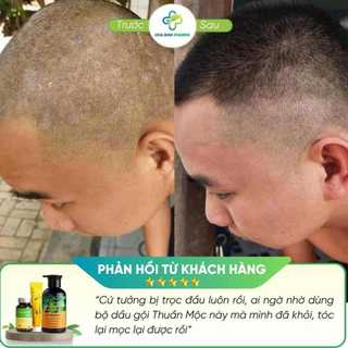 Dầu gội Thuần Mộc RAU MÁ giảm gàu ngứa, giảm nấm đầu, giảm rụng, kích thích mọc tóc