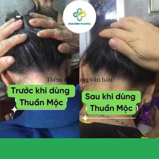Dầu gội Thuần Mộc RAU MÁ giảm gàu ngứa, giảm nấm đầu, giảm rụng, kích thích mọc tóc