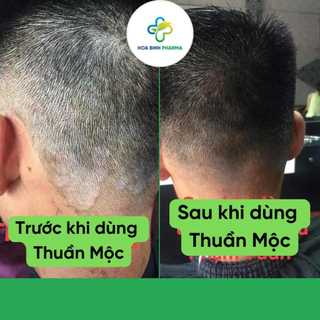 Dầu gội Thuần Mộc RAU MÁ giảm gàu ngứa, giảm nấm đầu, giảm rụng, kích thích mọc tóc