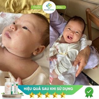 Sữa tắm Thuần Mộc Kids cho bé giảm rôm sẩy, mẩn ngứa, chàm