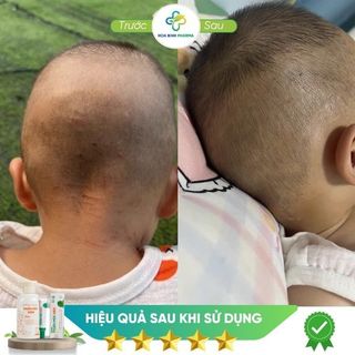 Sữa tắm Thuần Mộc Kids cho bé giảm rôm sẩy, mẩn ngứa, chàm