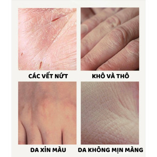 Kem Dưỡng Da Tay, Da chân + Tất silicon kem bôi da tay dưỡng ẩm Jingchunmimi 300g , làm trắng da, chống khô, nứt nẻ