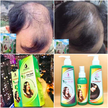 (MỚI) Phân loại Combo Tinh dầu bưởi NGÂN BÌNH, Dầu gội hoa bưởi, Dầu xả hương hoa bưởi Kích thích mọc tóc, Ngăn rụng tóc