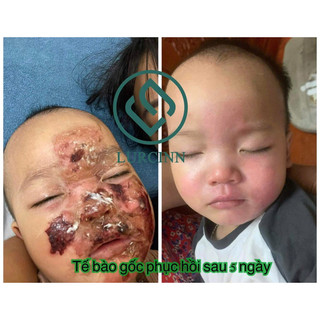 Serum Tế Bào Gốc Lurcinn Bio Centa Tái Tạo Phục Hồi Làn Da - 15g | An Mộc Spa