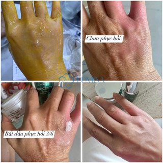 Serum Tế Bào Gốc Lurcinn Bio Centa Tái Tạo Phục Hồi Làn Da - 15g | An Mộc Spa