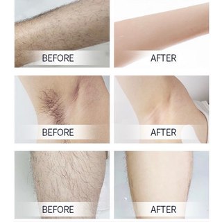 CCOMBO NỒI MINI+100G Sáp wax lông nóng sữa dừa cao cấp lyihome, sáp bám lông tốt dẻo và có mùi thơm
