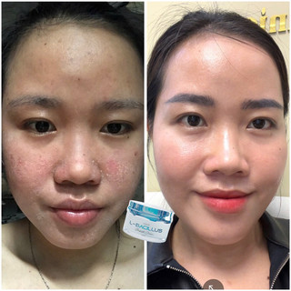 Kem Dưỡng Lurcos Bổ Sung Lợi Khuẩn L-Bacillus Tăng Độ Đàn Hồi, Cung Cấp Độ Ẩm 30g | An Mộc Spa