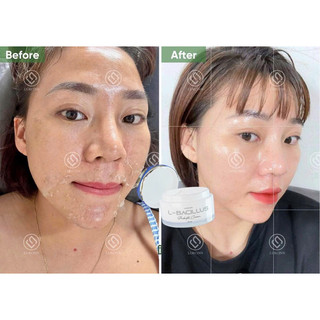 Kem Dưỡng Lurcos Bổ Sung Lợi Khuẩn L-Bacillus Tăng Độ Đàn Hồi, Cung Cấp Độ Ẩm 30g | An Mộc Spa