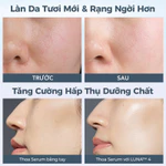 Máy rửa mặt FOREO LUNA 4 cao cấp được chứng minh lầm sàng làm sạch sâu mát-xa trẻ hoá da bằng sóng âm T-sonic phiên bản cho da nhạy cảm — ảnh 6