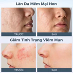 Máy rửa mặt FOREO LUNA 4 cao cấp được chứng minh lầm sàng làm sạch sâu mát-xa trẻ hoá da bằng sóng âm T-sonic phiên bản cho da nhạy cảm — ảnh 7