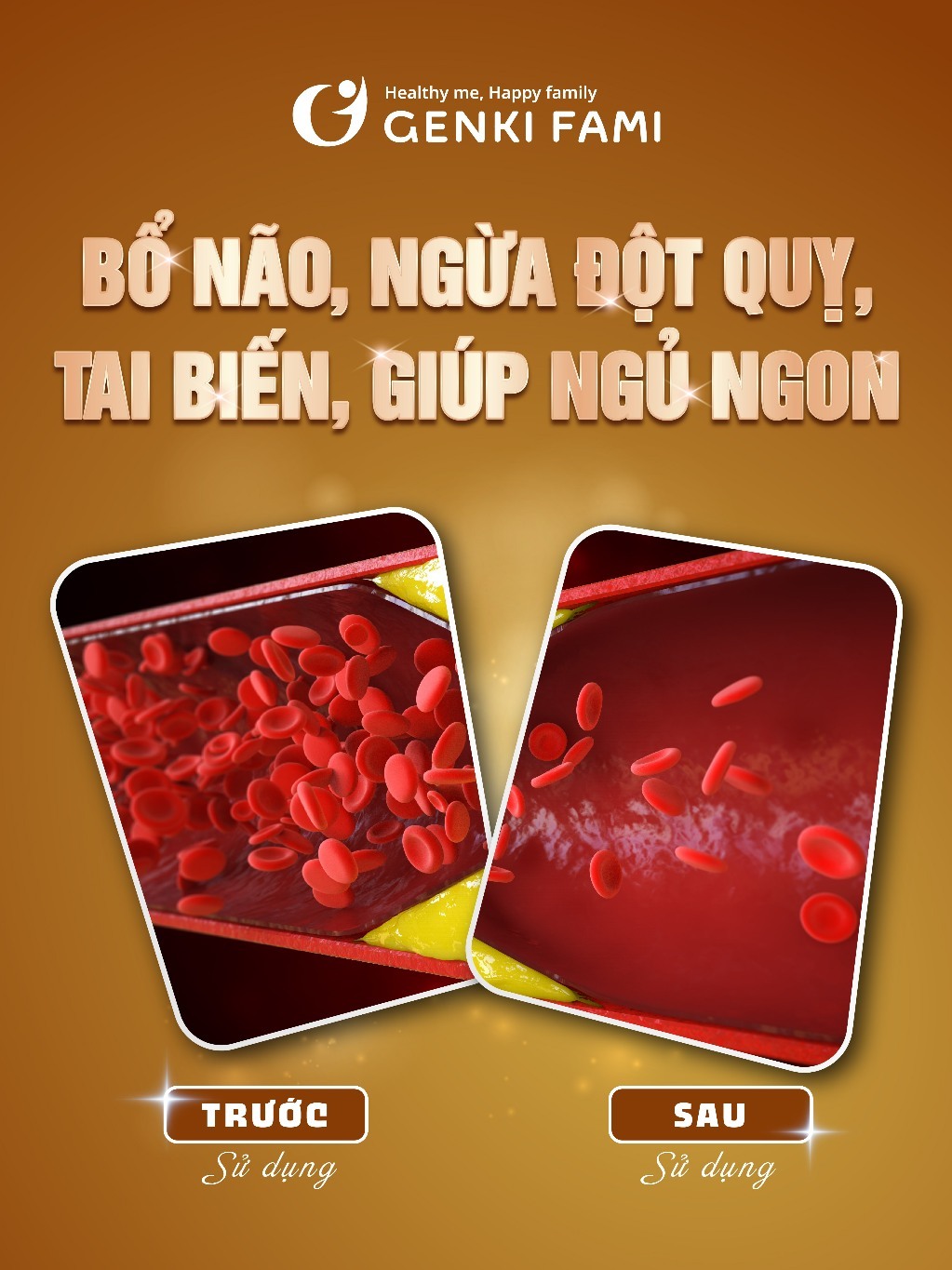 Ảnh Combo Viên Uống Bổ Não, Ngừa Đột Quỵ Tai Biến, Giúp Ngủ Ngon Nattokinase 3000FU Natto Ichou Genki Fami Nhật Bản 4