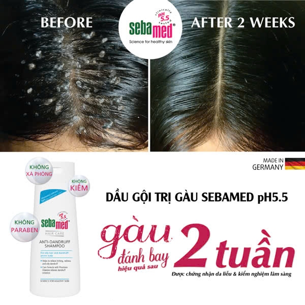 Ảnh Dầu gội giúp giảm gàu Sebamed Hair Care Anti-Dandruff Shampoo pH5.5 (200ml) 2