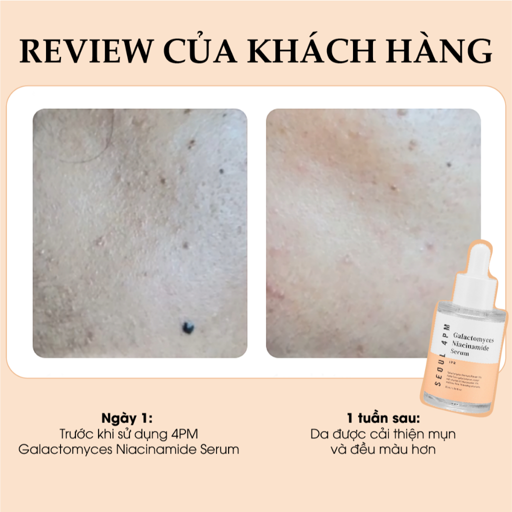 Ảnh Tinh Chất Dưỡng Sáng, Tăng Cường Hàng Rào Bảo Vệ Da 10% Galactomyces +10% Niacinamide 4PM Galactomyces Niacinamide Serum 4