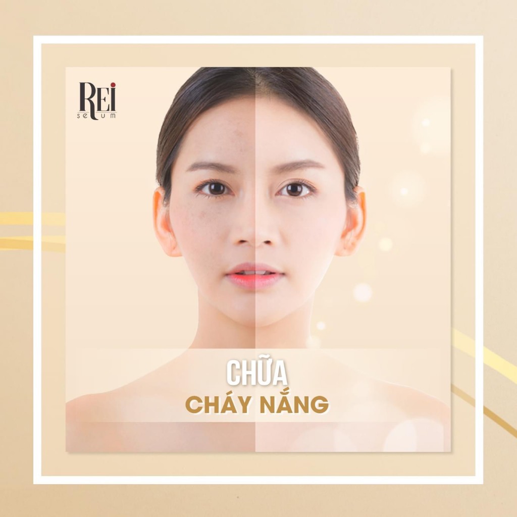 Tinh chất Tế bào gốc mô mỡ REI Serum T’s Kiss Nhật Bản dưỡng trắng, căng bóng và phục hồi da chuyên sâu Hộp 30 viên