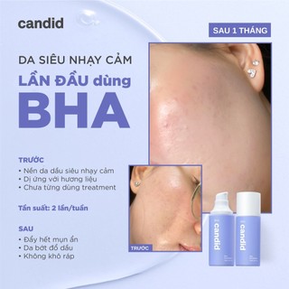 Gel Tẩy Tế Bào Chết Sạch Lỗ Chân Lông, Giảm Mụn Candid BHA Gel Exfoliant 100ml