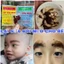 Cai Sữa Mẹo Cho Bé thành phần từ thiên nhiên, chỉ cần bôi không cần uống, không cần tách mẹ, an toàn hiệu quả nhanh