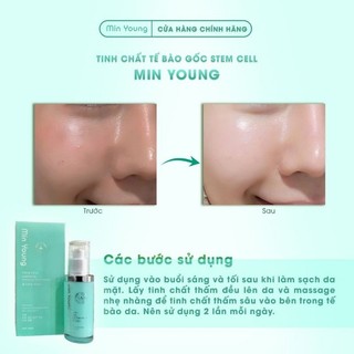 Min Young tinh chất tế bào gốc dưỡng trắng cải thiện sắc tố da trẻ hóa làn da 40ml