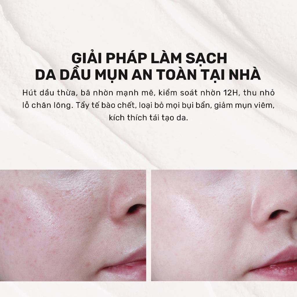 Ảnh (KOL) Mặt Nạ Đất Sét Hút Dầu Kiểm Soát Nhờn 12H Derladie Vegan Pink Clay Mask Deep Pore Tightening 2
