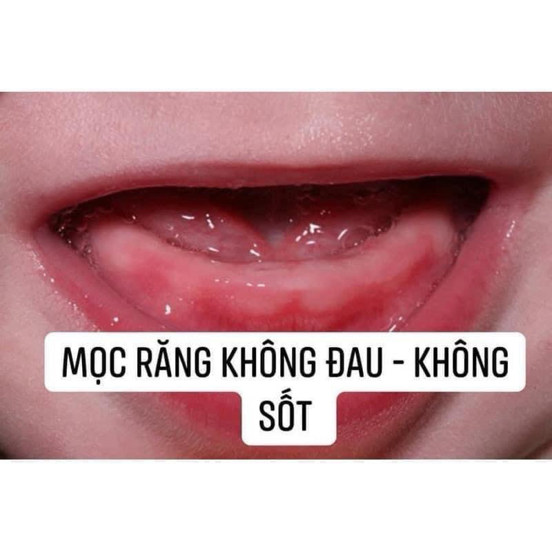 Gel bôi nướu Detinox - Gen N 10g - giảm khó chịu, an toàn cho bé - nội địa Đức [tibongstore]