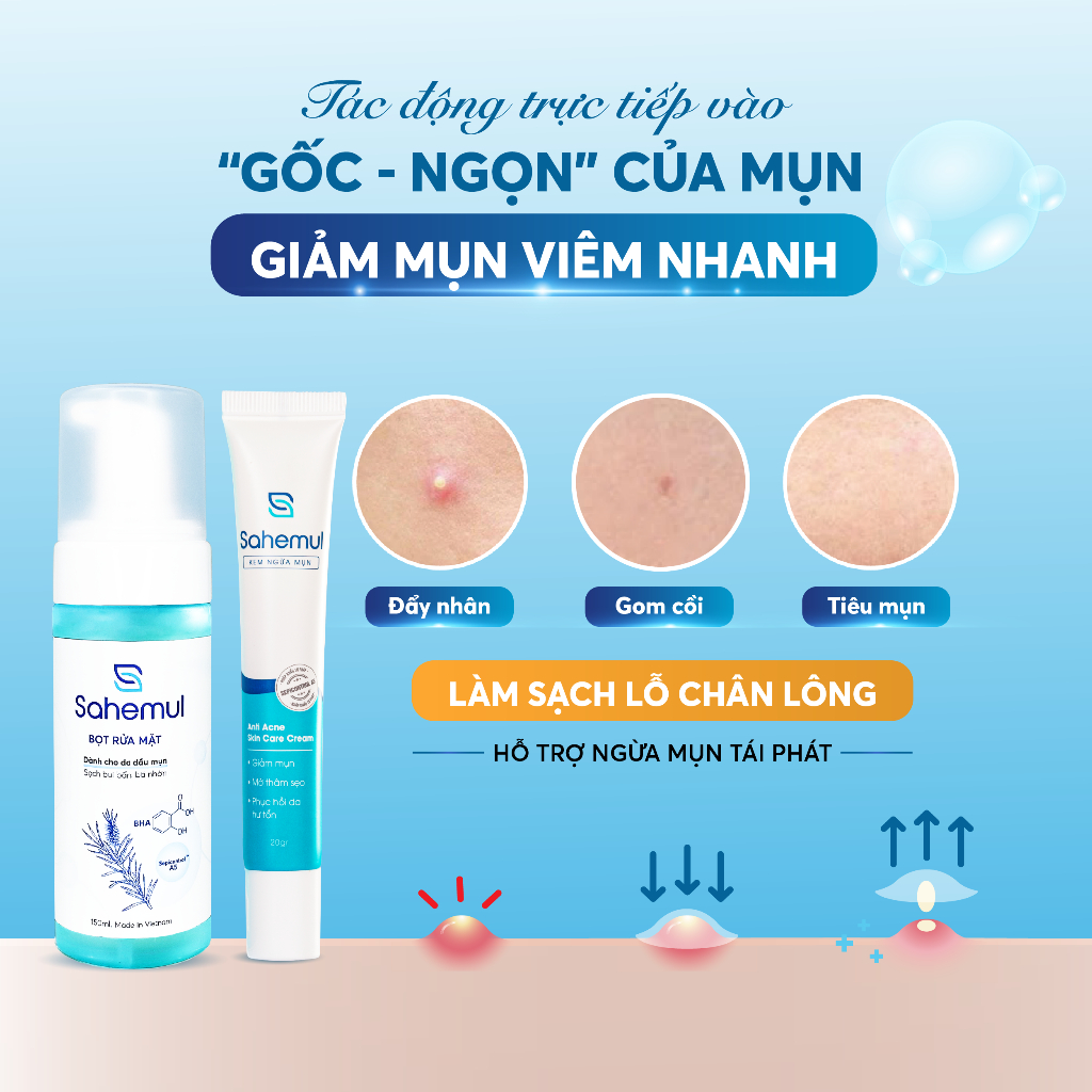 Review Combo Sahemul Giảm Mụn Nhanh: Kem Chấm Mụn Viêm & Bọt Rửa Mặt Sạch Sâu