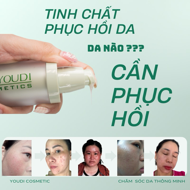 Serum giúp phục hồi da mỏng yếu cấp ẩm dưỡng trắng YOUDI 30ml