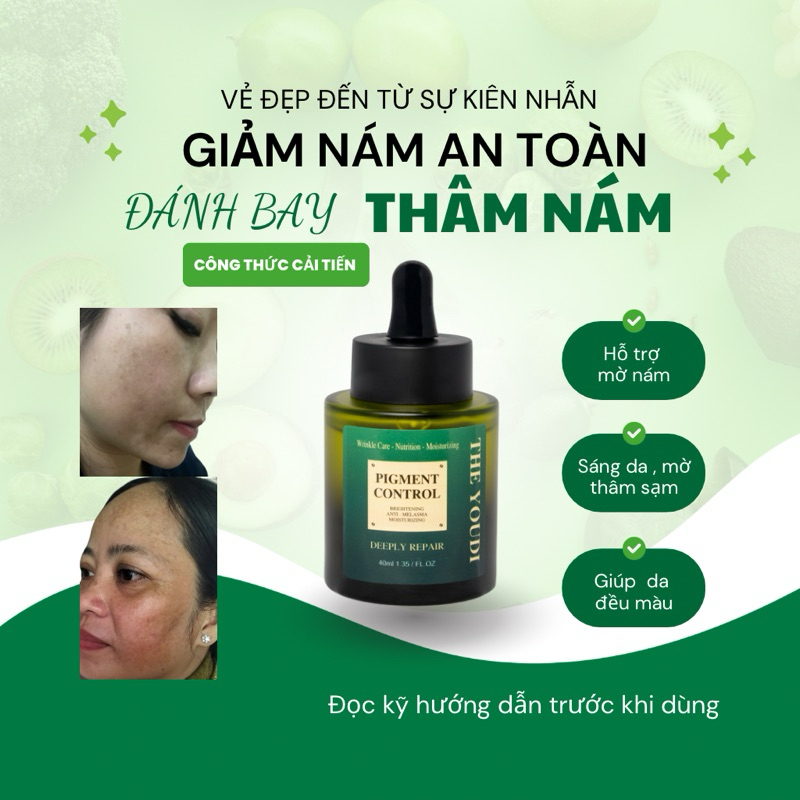 YOUDI Serum Giảm Nám Tàn Nhang Đốm Nâu Và Dưỡng Trắng Da 40ml