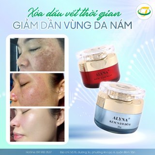 Kem dưỡng ngày Collagen Vip Alyna - hỗ trợ làm mờ nám