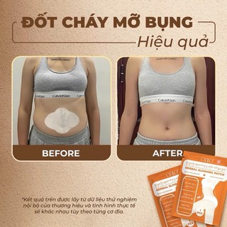 OHIO HERBAL SLIMMING PATCH MIẾNG DÁN TAN MỠ
