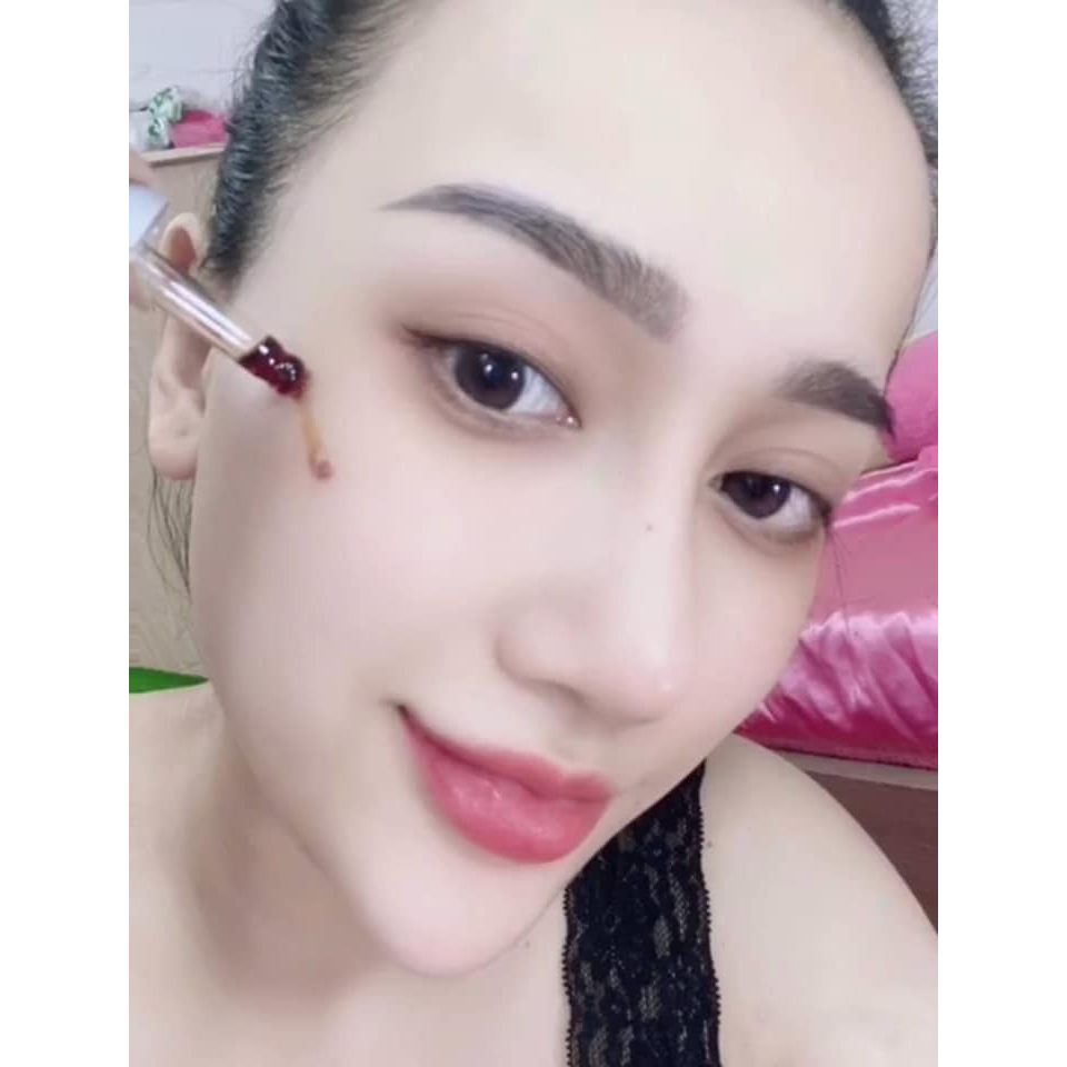 Serum thảo dược giảm mụn, mờ thâm 7 ngày Zenmy spa (Tinh chất trị mụn)