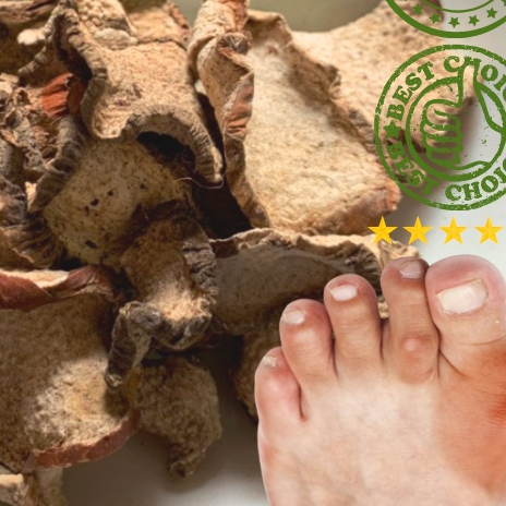 Củ Ráy Khô 1kg (Ráy Rừng, Ráy Dại) Tốt Cho Người Bệnh Gout, Hàng Sạch ...