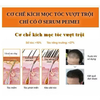 Serum DHT kích tóc mọc tóc đen dày, bóng khỏe, giảm gãy rụng