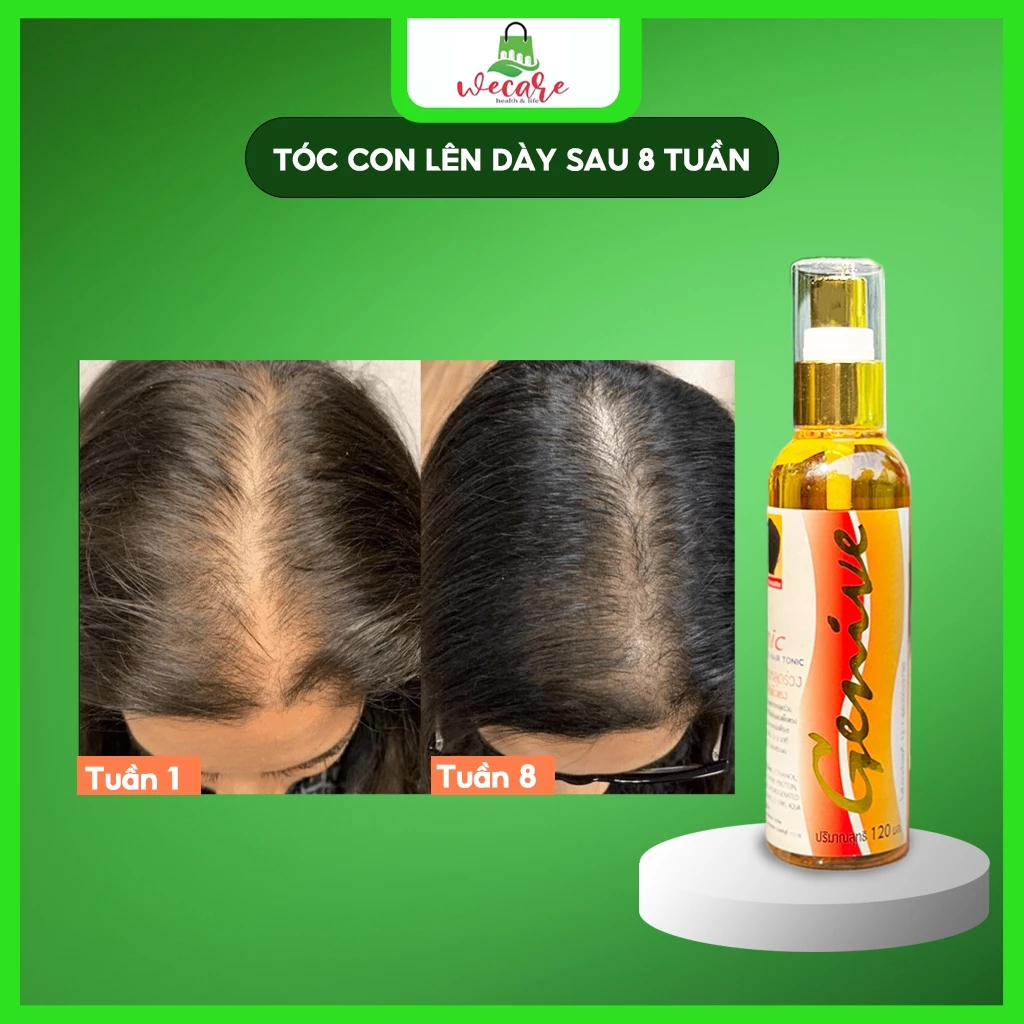 Chai xịt mọc tóc Tonic Hair GENIVE 120ml Chính Hãng Thái Lan ngăn ngừa rụng tóc