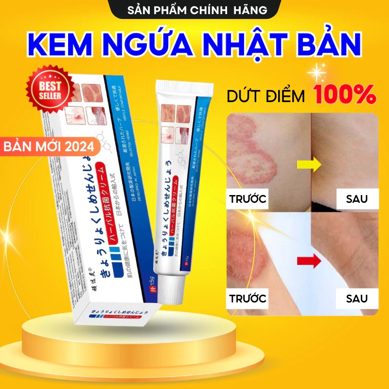 Kem Bôi Nấm Ngứa Viêm Da Cơ Địa NHẬT BẢN Hắc Lào, Tổ Đỉa, Vẩy Nến, Á Sừng, Lang Ben Hiệu Quả