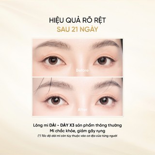 Combo 2 Serum Dưỡng Mi LONG4LASHES White (3ml x 2) - Tinh Chất Giảm Gãy Rụng, Hỗ Trợ Dài Và Dày Mi Chính Hãng Ba Lan