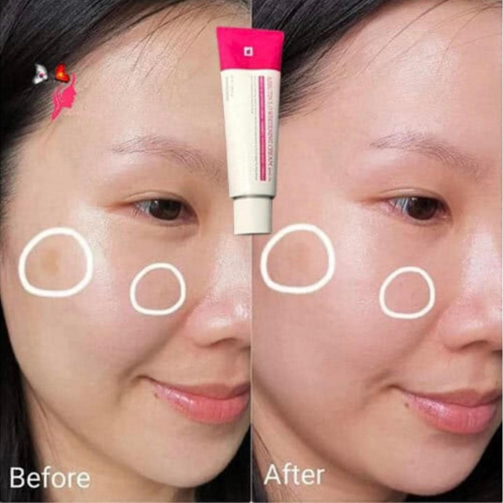Ảnh Kem dưỡng sáng da mặt ARBUTIN hỗ trợ mờ nám đều màu giúp da căng ẩm giảm lão hóa 50ml 1