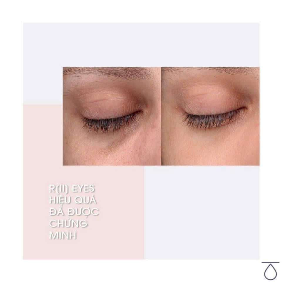 Kem Mắt Giảm Quầng Thâm, Bọng Mắt Teoxane RII Eyes Contour