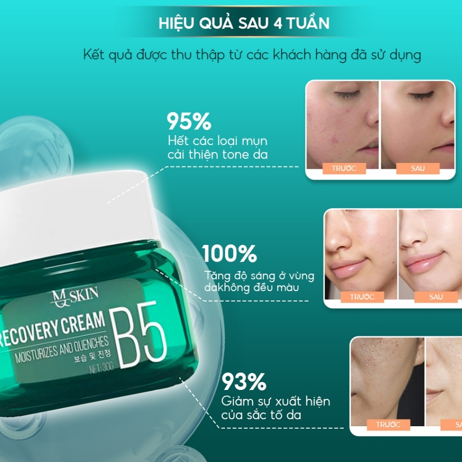 Ảnh Kem Dưỡng Ẩm B5 MQ Skin Phục Hồi Làn Da, Giảm Thâm Nám, Giúp Da Căng Mọng-  Recovery Cream Kem B5 Mới 30g 3