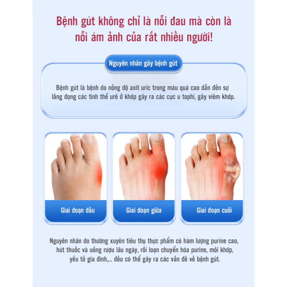Gel lạnh thoa gout, giảm đau, cải thiện tình trạng đau nhức khớp gối, khớp ngón tay, chân hiệu quả