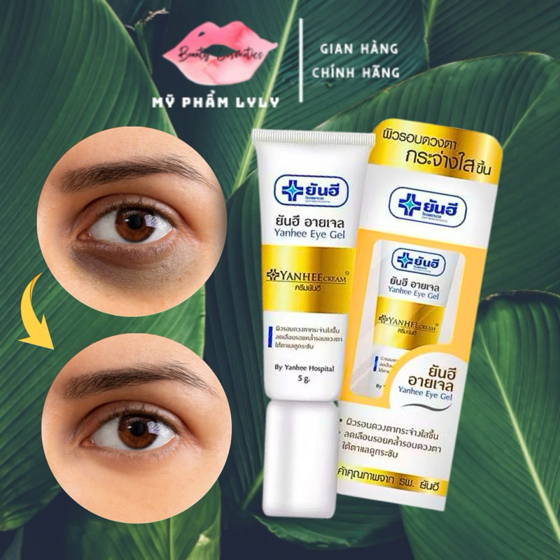 Kem Thâm Mắt YANHEE EYE Cao Cấp Kem Dưỡng Mắt Loại Bỏ Quầng Thâm Bọng Mắt Chống Lão Hóa Xóa Mờ Nếp Nhăn