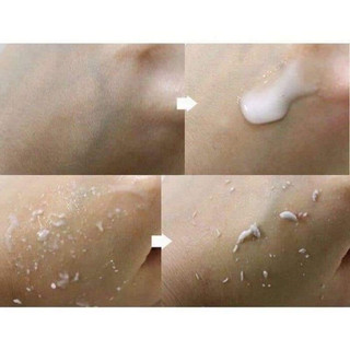 Tẩy Tế Bào Chết Mặt 3W Clinic Moisture Peeling Gel 180ml