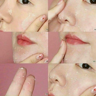 Tẩy Tế Bào Chết Mặt 3W Clinic Moisture Peeling Gel 180ml