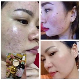 Combo 2 Bộ Kem Face Tái Tạo Da Gia Truyền Giúp Da Căng Bóng Mịn Màng Sạch Nám Mụn Tàn Nhang
