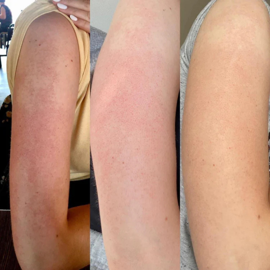 Kem dưỡng Body GOLD BOND ULTIMATE ROUGH BUMPY SKIN giảm thâm, sần mông chính hãng, của Mỹ