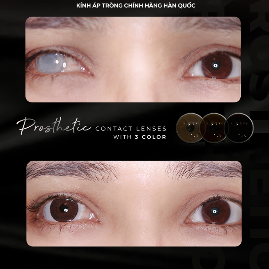 Lens Thẩm Mỹ Che Khuyết Điểm An.gel Ey.es, Kính Áp Tròng Cho Mắt Bị Đục Thủy Tinh Thể, Kéo Mây, Cườm