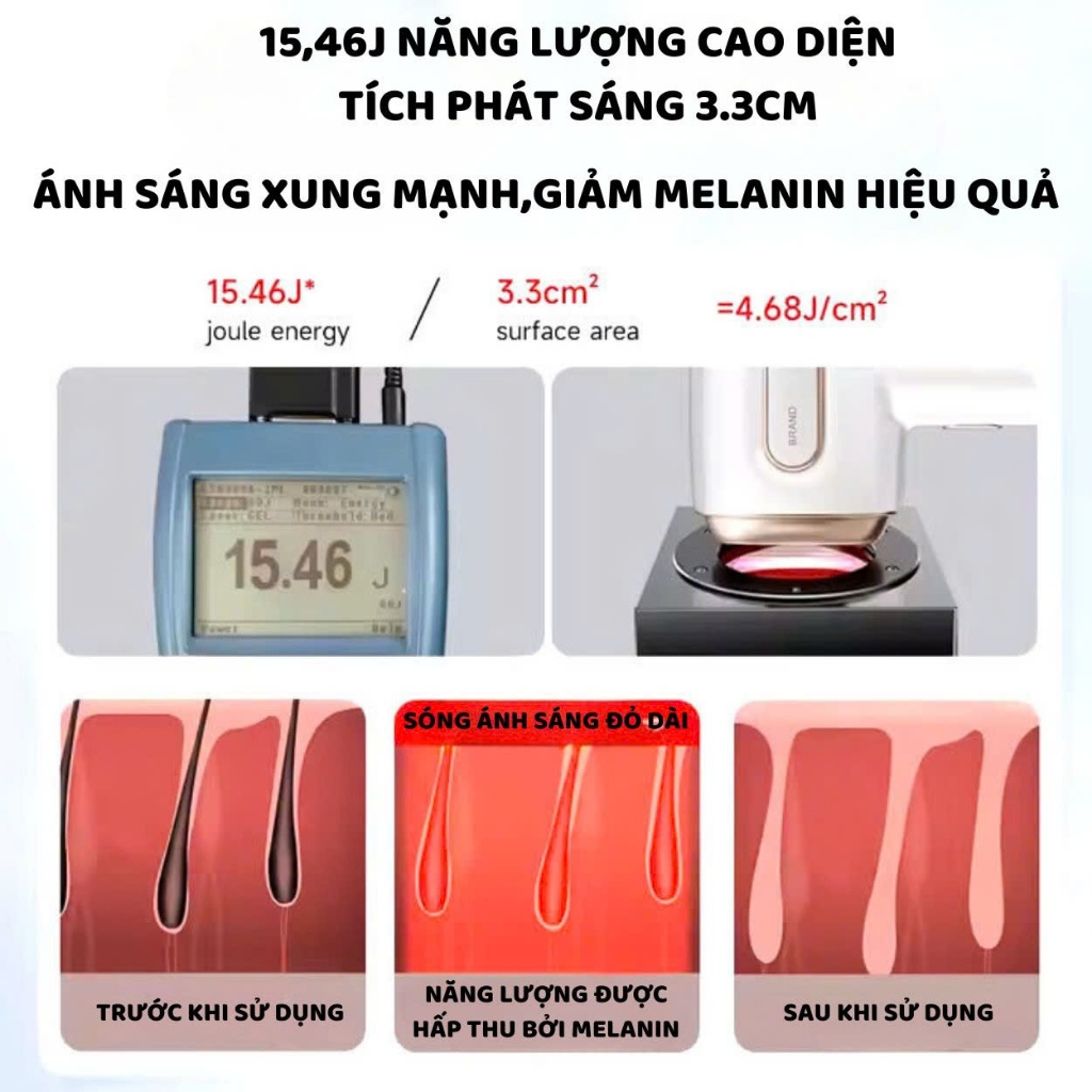 Ảnh Máy triệt lông ENZO cao cấp, công nghệ IPL giảm thâm trẻ hóa da, triệt lạnh ICE, Bảo Hành 10 Năm 3