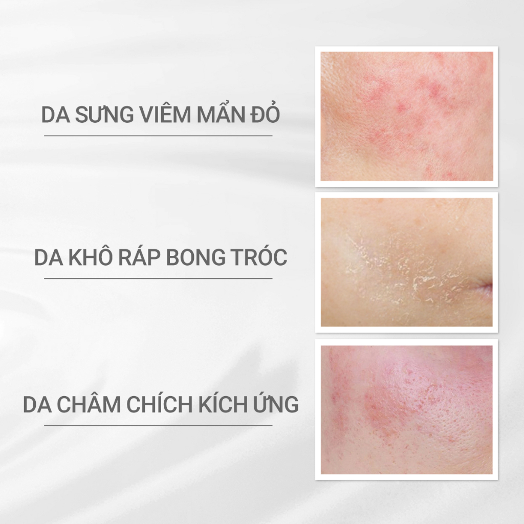 Ảnh Combo làm sạch và phục hồi dProgram Essence Cleansing Foam 120g và Skin Repair Cream 45g 2