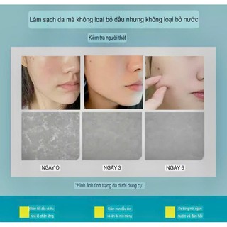 Sữa Rửa Mặt Kích Trắng Collagen Yến Tươi, Sữa Rửa Mặt Trắng Da Làm Sạch Sâu Giảm Mụn Kiểm Soát Dầu Nhờn 110g