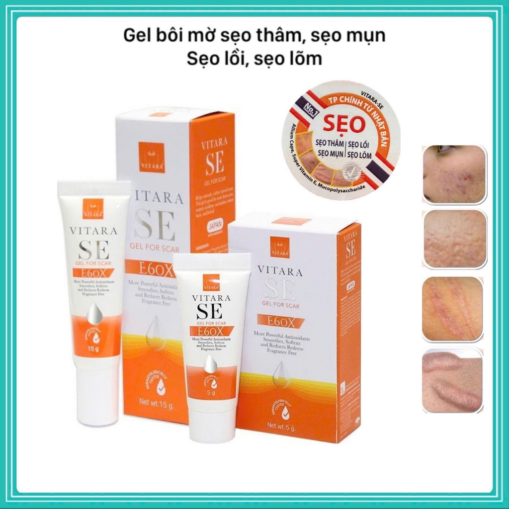 Vitara SE Gel bôi mờ sẹo mờ vết thâm | Shopee Việt Nam